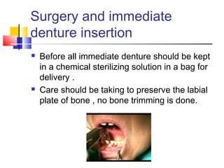 Surgery and immediate
denture insertion
 Before all immediate denture should be kept
in a chemical sterilizing solution in a bag for
delivery .
 Care should be taking to preserve the labial
plate of bone , no bone trimming is done.
 