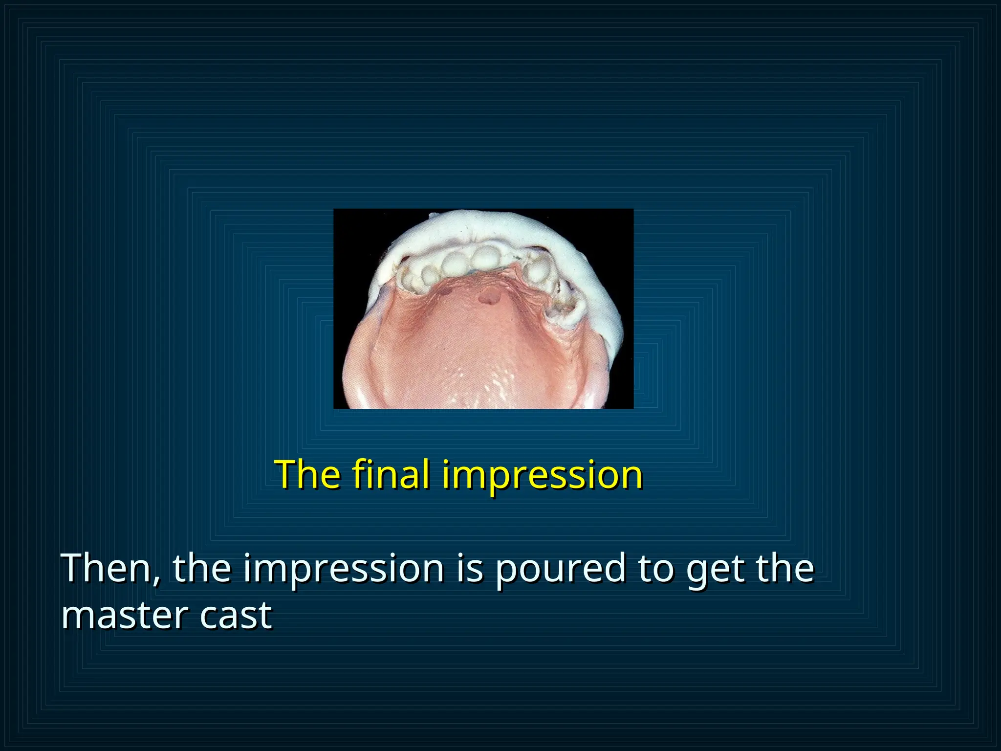 Fixed Impression immediate denture part 1 modified (2024).ppt