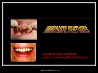 INDIAN DENTAL ACADEMY
Leader in continuing Dental Education
www.indiandntalacademy.com
 