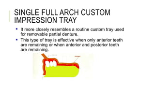 SINGLE FULL ARCH CUSTOM
IMPRESSION TRAY
 
