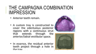 THE CAMPAGNA COMBINATION
IMPRESSION
 