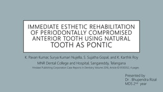 IMMEDIATE ESTHETIC REHABILITATION
OF PERIODONTALLY COMPROMISED
ANTERIOR TOOTH USING NATURAL
TOOTH AS PONTIC
K. Pavan Kumar, Surya Kumari Nujella, S. Sujatha Gopal, and K. Karthik Roy
MNR Dental College and Hospital, Sangareddy, Telangana
Hindawi Publishing Corporation Case Reports in Dentistry Volume 2016, Article ID 8130352, 4 pages
Presented by
Dr . Bhupendra Rizal
MDS 2nd year
 