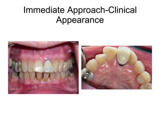Immediate Approach-Clinical Appearance 