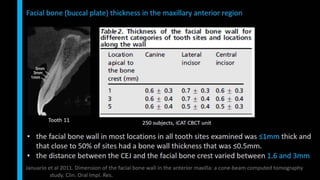 Immediate implant placement in single tooth situations