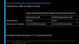 Immediate implant placement in single tooth situations