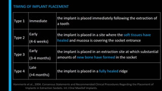 Immediate implant placement in single tooth situations