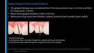Immediate implant placement in single tooth situations