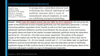 Immediate implant placement in single tooth situations