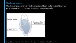 Immediate implant placement in single tooth situations