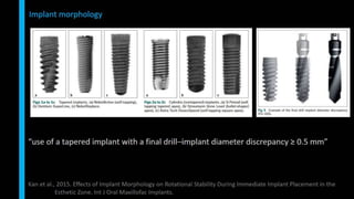 Immediate implant placement in single tooth situations