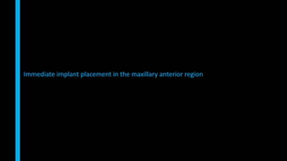 Immediate implant placement in single tooth situations