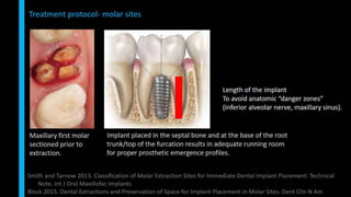 Immediate implant placement in single tooth situations