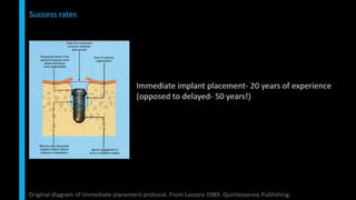 Immediate implant placement in single tooth situations