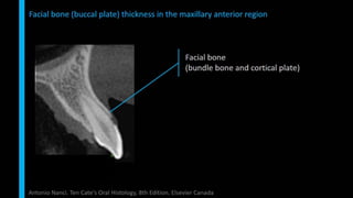 Immediate implant placement in single tooth situations