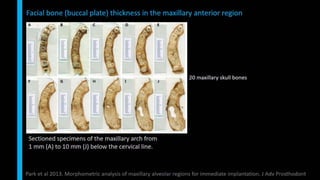 Immediate implant placement in single tooth situations