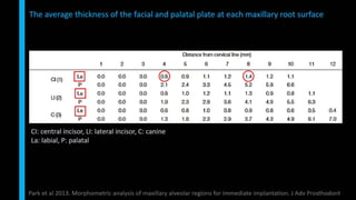 Immediate implant placement in single tooth situations