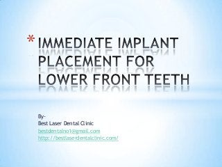 By-
Best Laser Dental Clinic
bestdentalno1@gmail.com
http://bestlaserdentalclinic.com/
*
 