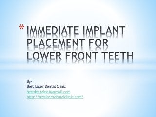 By-
Best Laser Dental Clinic
bestdentalno1@gmail.com
http://bestlaserdentalclinic.com/
*
 