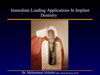 Immediate Loading Applications In Implant Dentistry  Dr. Mohammed Alshehri   BDS, AEGD, SSC-Resto, SF-DI 