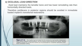 Immediate loading | PPTX