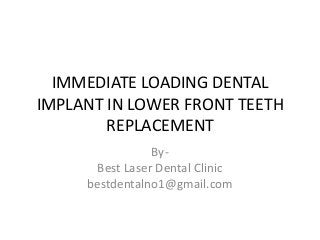 IMMEDIATE LOADING DENTAL
IMPLANT IN LOWER FRONT TEETH
REPLACEMENT
ByBest Laser Dental Clinic
bestdentalno1@gmail.com

 