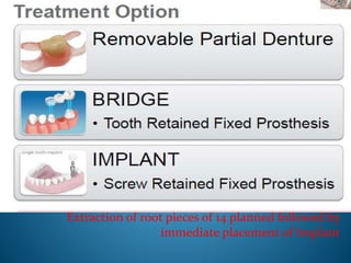 Immediate single implant case presentation | PPTX