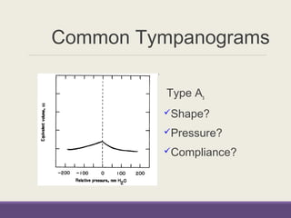 Common Tympanograms
Type As
Shape?
Pressure?
Compliance?
 