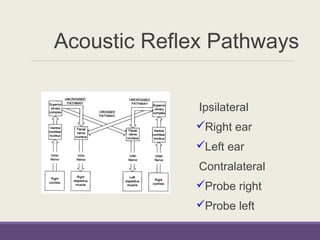 Acoustic Reflex Pathways
Ipsilateral
Right ear
Left ear
Contralateral
Probe right
Probe left
 