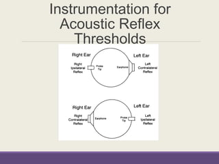 Instrumentation for
Acoustic Reflex
Thresholds
 