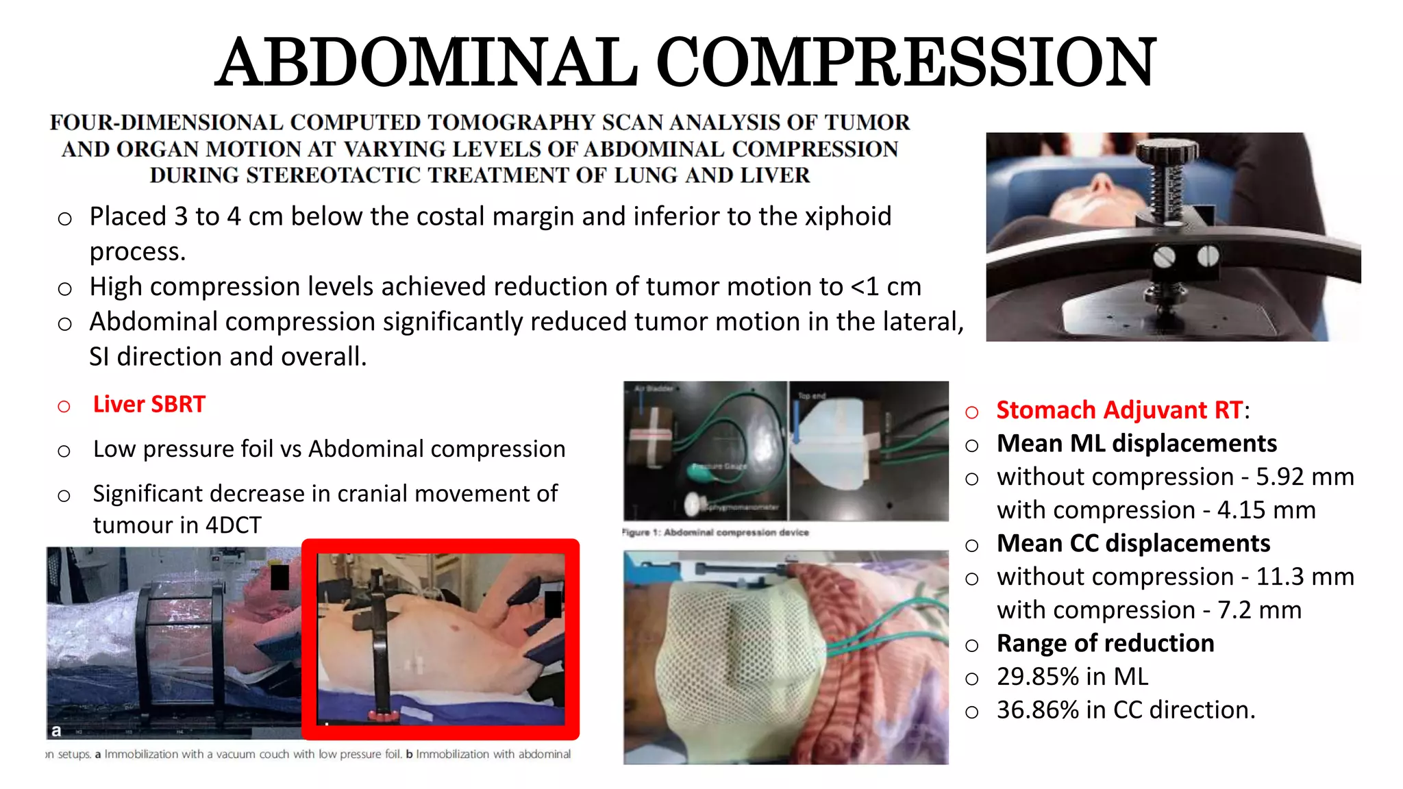 Immobilisation in Radiotherapy | PPTX