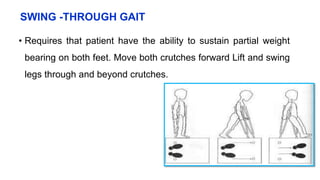 SWING -THROUGH GAIT
• Requires that patient have the ability to sustain partial weight
bearing on both feet. Move both crutches forward Lift and swing
legs through and beyond crutches.
 