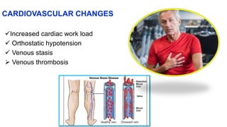 CARDIOVASCULAR CHANGES
Increased cardiac work load
 Orthostatic hypotension
 Venous stasis
 Venous thrombosis
 