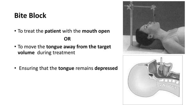 Immobilization device in radiotherapy | PDF