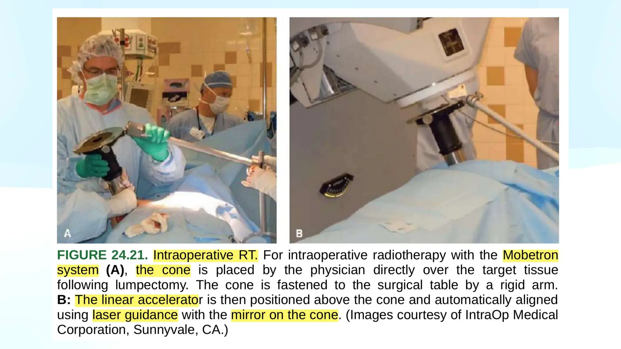 Immobilization Devices.pptx ;DR YAMINI ; RADIOTHERAPY ; AIIMS GORAKHPUR ...