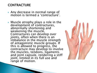 IMMOBILIZATION Effects.pptx