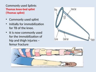 Comprehensive Guide to Immobilization Techniques Using Splints and ...