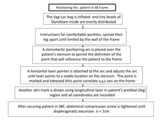 Positioning the patient in SB Frame
The Vag-Loc bag is inflated and tiny beads of
Styrofoam inside are evenly distributed
Instructions for comfortable position, spread their
leg apart until limited by the wall of the frame
A stereotactic positioning arc is placed over the
patient’s sternum to permit the definition of the
point that will reference the patient to the frame
A horizontal laser pointer is attached to the arc and adjusts the arc
until laser points to a stable location on the sternum. The point is
marked and tattooed (this point correlate x,y,z axis on the frame
Another skin mark is drawn using longitudinal laser in patient’s pretibial (leg)
region and all coordinates are recorded
After securing patient in SBF, abdominal compression screw is tightened until
diaphragmatic excursion is < 1cm
 