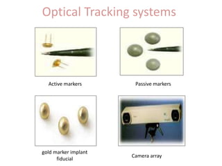 Optical Tracking systems
Active markers Passive markers
Camera array
gold marker implant
fiducial
 