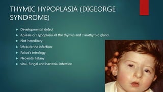 THYMIC HYPOPLASIA (DIGEORGE
SYNDROME)
 Developmental defect
 Aplasia or Hypoplasia of the thymus and Parathyroid gland
 Not hereditary
 Intrauterine infection
 Fallot’s tetrology
 Neonatal tetany
 viral, fungal and bacterial infection
 