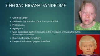 CHEDIAK HIGASHI SYNDROME
 Genetic disorder
 Decreased pigmentation of the skin, eyes and hair
 Photophobia
 Nystagmus
 Giant peroxidase positive inclusions in the cytoplasm of leukocytes due to
autophagocytic activity
 Diminished phagocytic activity
 Frequent and severe pyogenic infections
 