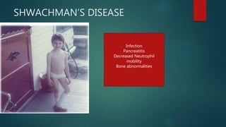 SHWACHMAN’S DISEASE
Infection
Pancreatitis
Decreased Neutrophil
mobility
Bone abnormalities
 
