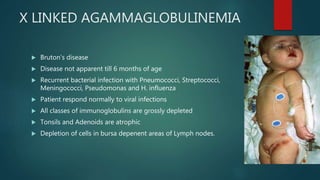 X LINKED AGAMMAGLOBULINEMIA
 Bruton’s disease
 Disease not apparent till 6 months of age
 Recurrent bacterial infection with Pneumococci, Streptococci,
Meningococci, Pseudomonas and H. influenza
 Patient respond normally to viral infections
 All classes of immunoglobulins are grossly depleted
 Tonsils and Adenoids are atrophic
 Depletion of cells in bursa depenent areas of Lymph nodes.
 
