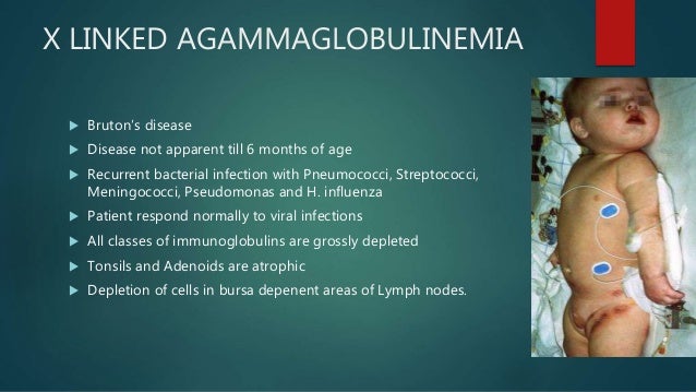 Immunodeficiency diseases