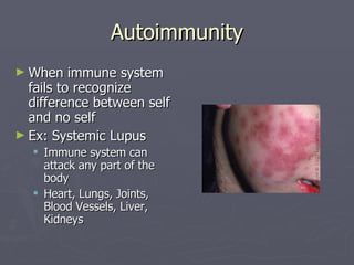 Immune System | PPT