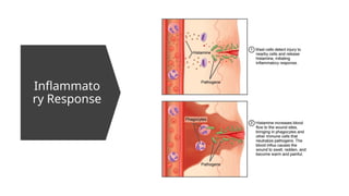 Inflammato
ry Response
 