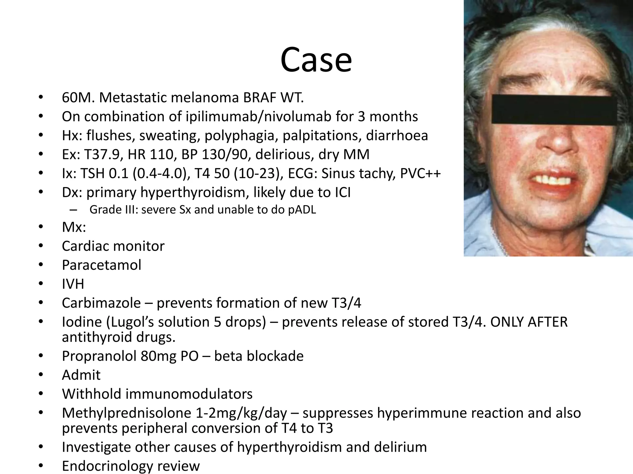 Case
• 60M. Metastatic melanoma BRAF WT.
• On combination of ipilimumab/nivolumab for 3 months
• Hx: flushes, sweating, polyphagia, palpitations, diarrhoea
• Ex: T37.9, HR 110, BP 130/90, delirious, dry MM
• Ix: TSH 0.1 (0.4-4.0), T4 50 (10-23), ECG: Sinus tachy, PVC++
• Dx: primary hyperthyroidism, likely due to ICI
– Grade III: severe Sx and unable to do pADL
• Mx:
• Cardiac monitor
• Paracetamol
• IVH
• Carbimazole – prevents formation of new T3/4
• Iodine (Lugol’s solution 5 drops) – prevents release of stored T3/4. ONLY AFTER
antithyroid drugs.
• Propranolol 80mg PO – beta blockade
• Admit
• Withhold immunomodulators
• Methylprednisolone 1-2mg/kg/day – suppresses hyperimmune reaction and also
prevents peripheral conversion of T4 to T3
• Investigate other causes of hyperthyroidism and delirium
• Endocrinology review
 