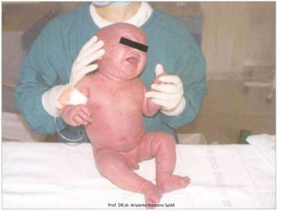 Prof DR.dr. Ariyanto Harsono SpAK

 