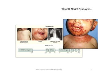 Wiskott Aldrich Syndrome…

Prof Ariyanto Harsono MD PhD SpA(K)

33

 