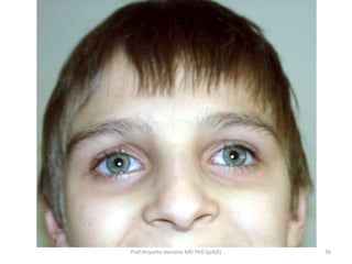 Prof Ariyanto Harsono MD PhD SpA(K)

36

 