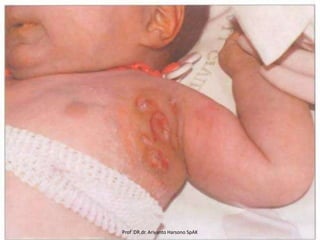 Prof DR.dr. Ariyanto Harsono SpAK

 